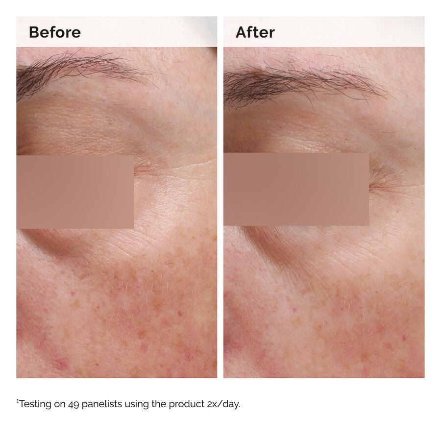 niacinamide-5-face-and-body-emulsion-x5 2024-08-23-ORD-Nia-5pct-Face-Body-B-A-Elasticity-Global-02-1x1.jpg