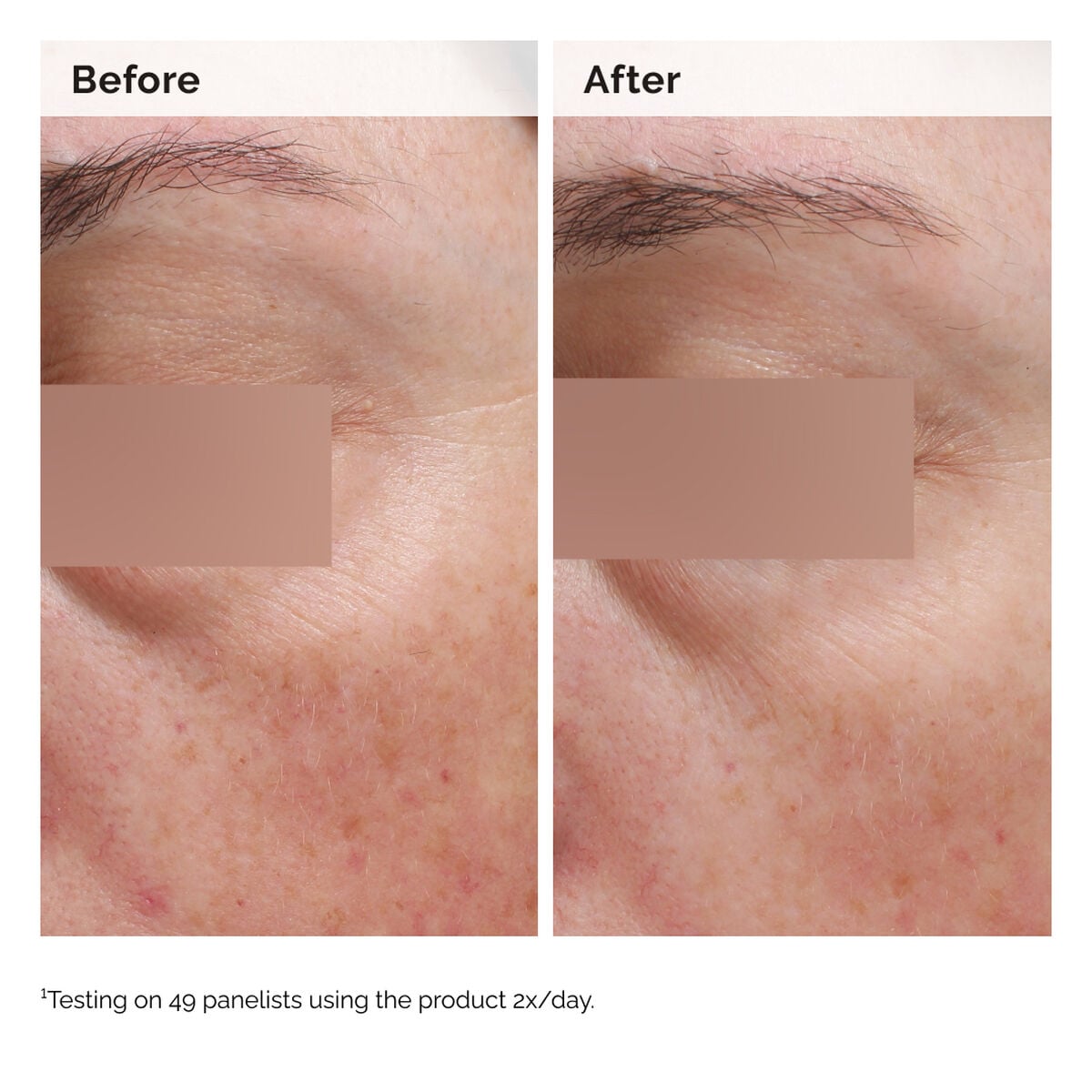 niacinamide-5-face-and-body-emulsion-x5 2024-08-23-ORD-Nia-5pct-Face-Body-B-A-Elasticity-Global-02-1x1.jpg