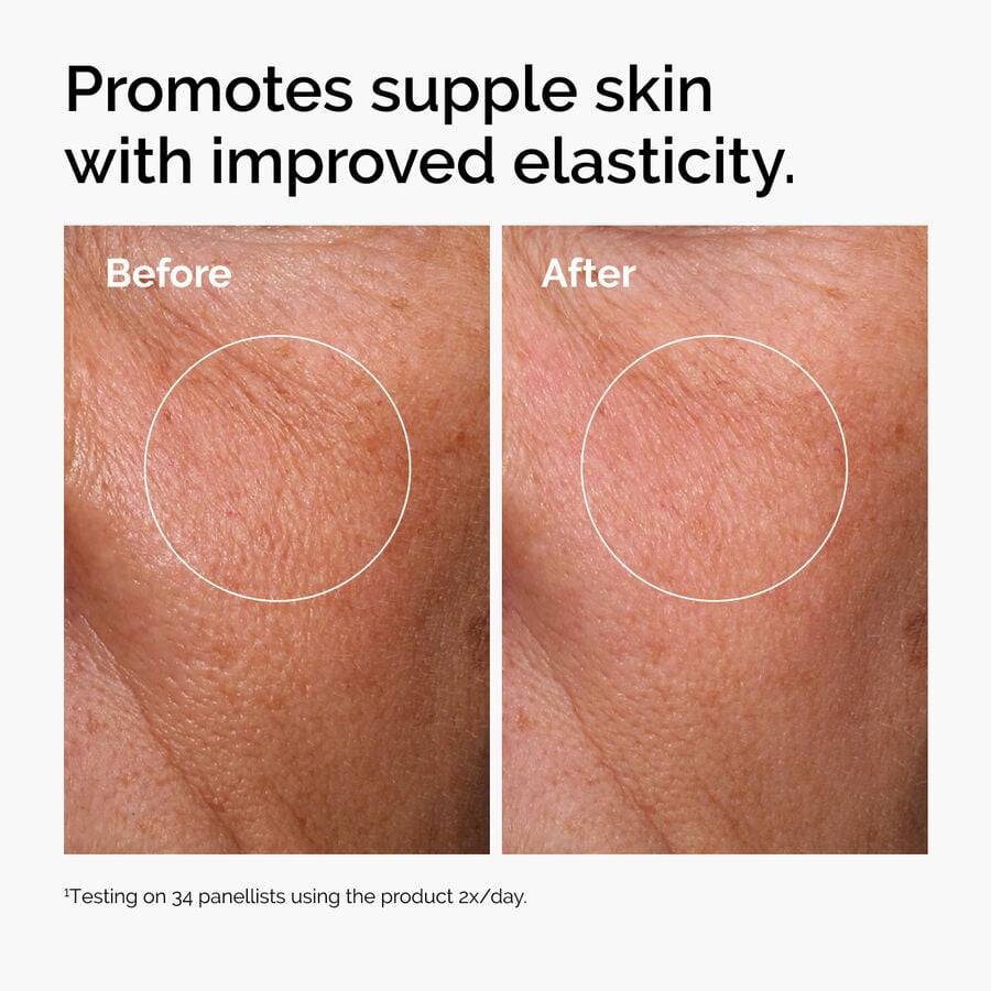 hyaluronic-acid-2-b5-with-ceramides-v3 ord-hyaluronic-acid-2pct-b5-hydrating-serum-before-after-elasticity.jpg