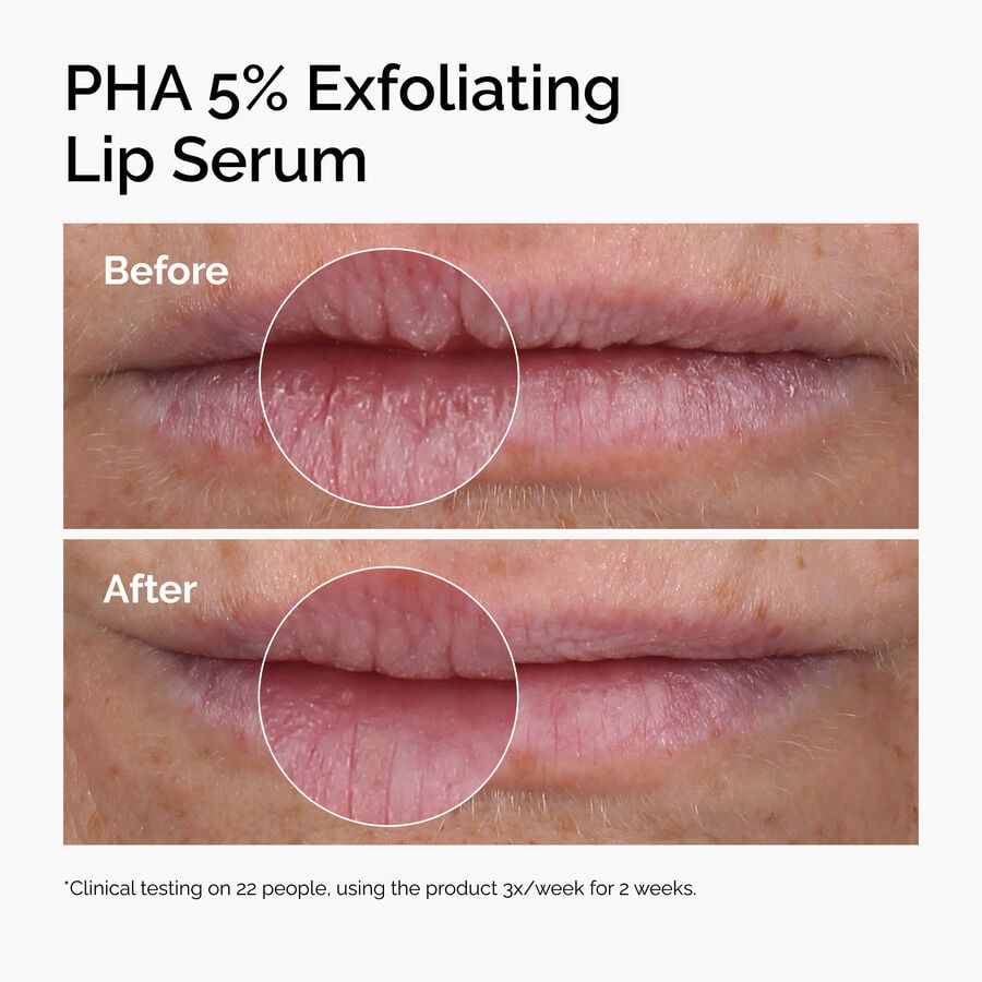 pha-5-exfoliating-lip-serum-s1 ord-pha-5pct-lip-exfoliating-serum-before-after.jpg