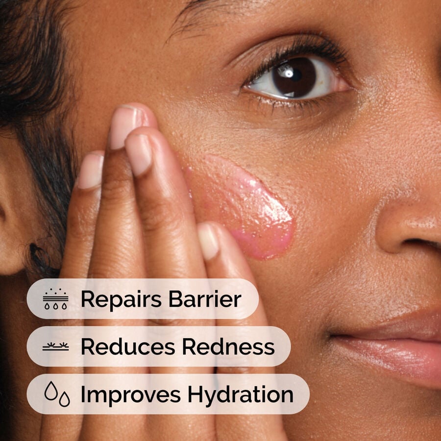 soothing-and-barrier-support-serum-set-u4 ord-soothing-barrier-support-serum-model-application-with-benefits.jpg